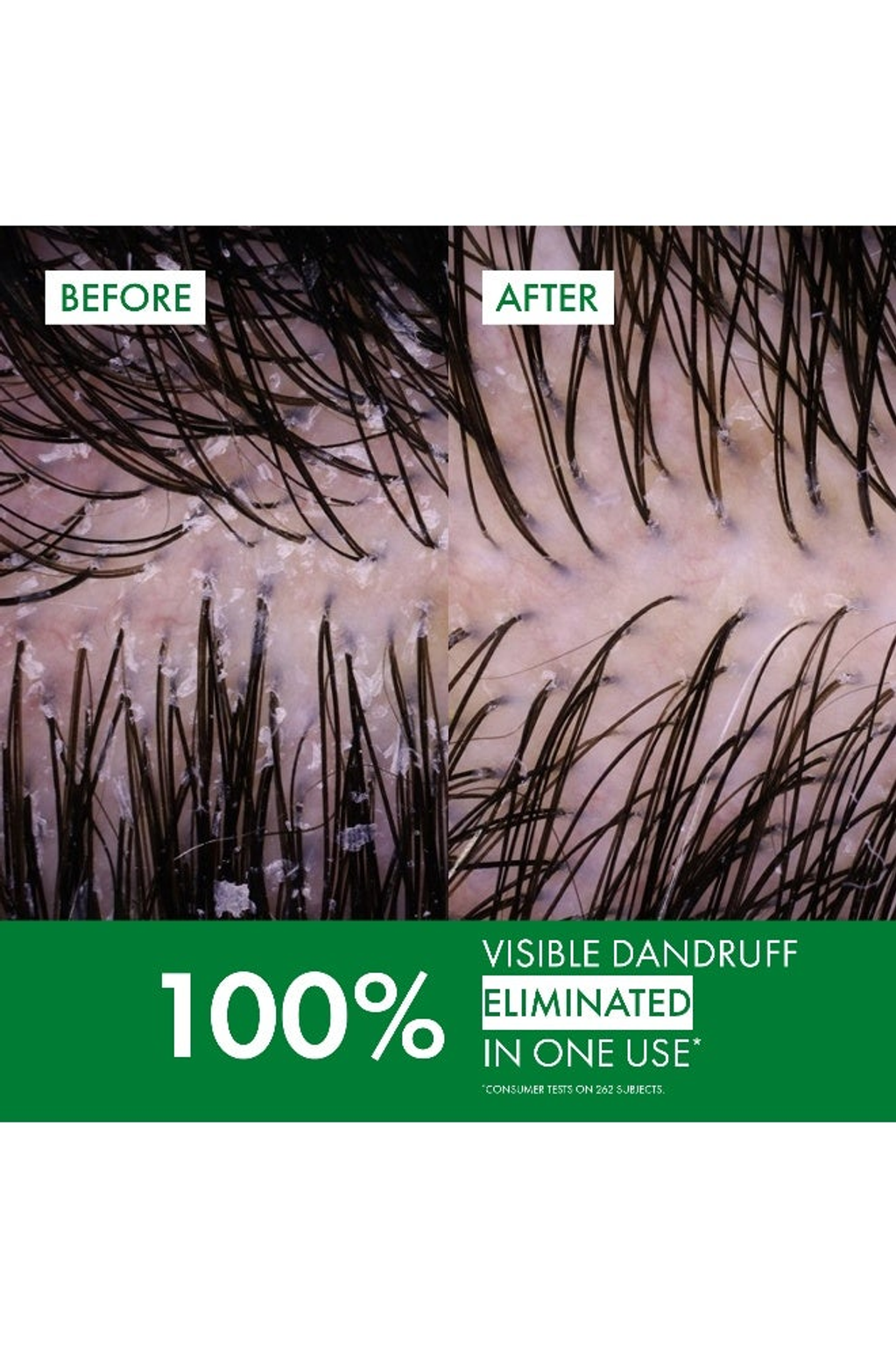 Vichy Dercos Anti-Dandruff Shampoo for Normal to Oily Hair 200ml - detail